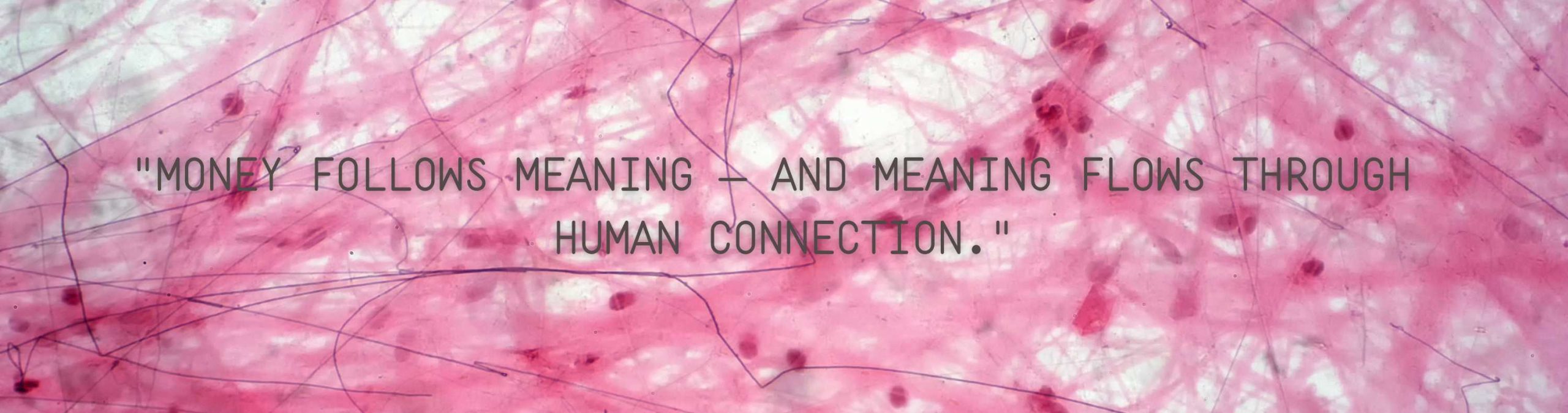 Text on pink background of areolar connective tissue